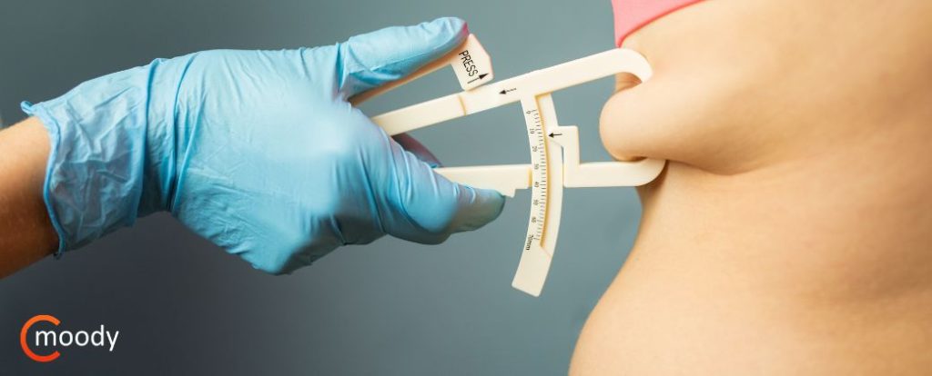 איך לבחור מנתח לשאיבת שומן – קריטריונים חשובים לפני החלטה